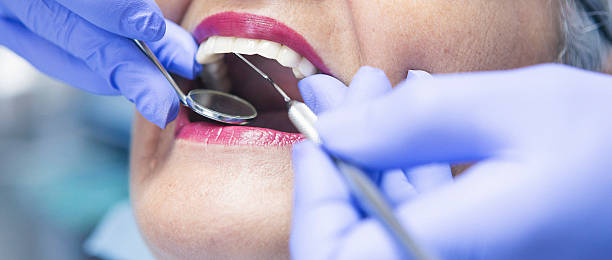 Best Emergency Wisdom Teeth Removal in Okolona, MS